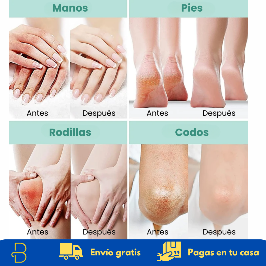 Crema Reparadora Intensiva con Urea 40 % para Pies y Manos - Recupera la suavidad